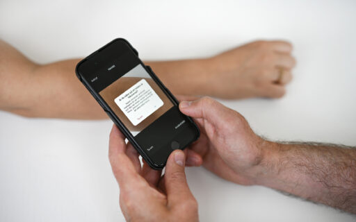 Dermicus AI Focus a new AI feature